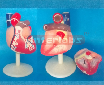 MIDDLE MAGNIFIED HEART, MODEL ASIASTYLE,(2PCS)